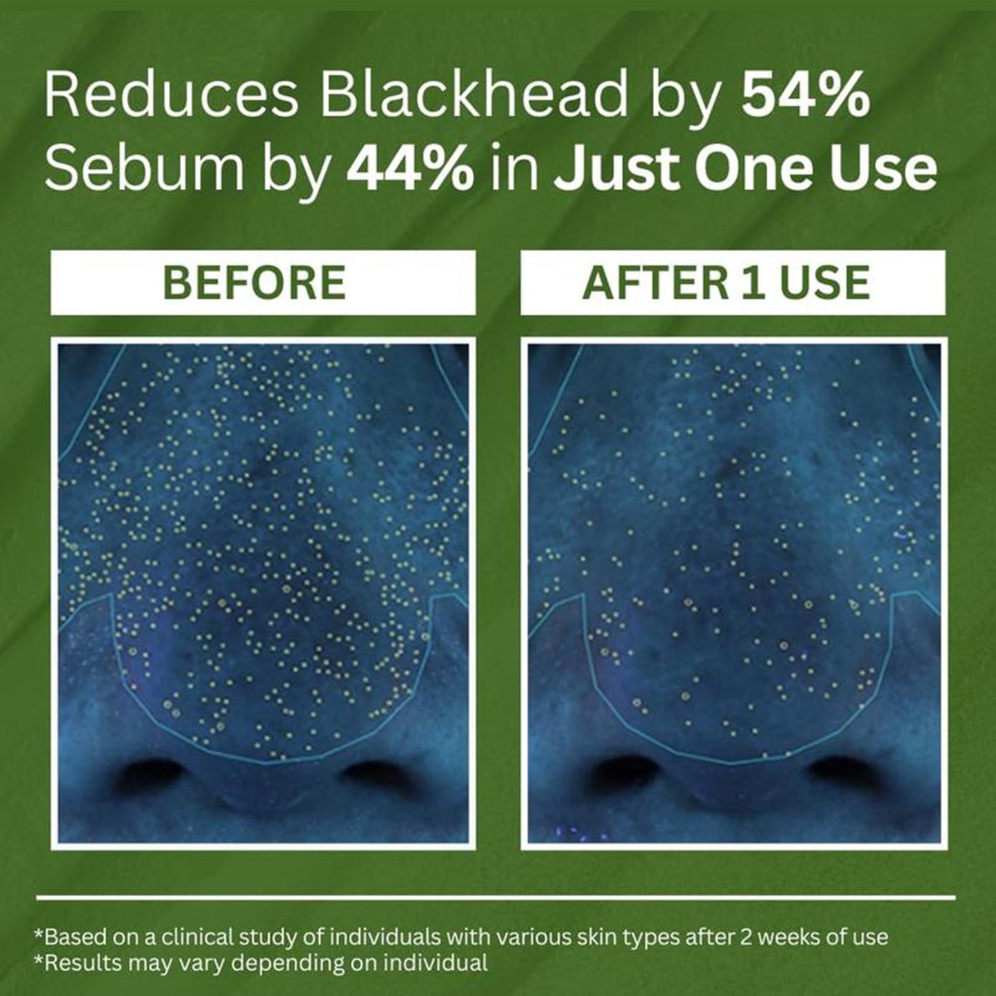 Barubat Holy Basil Bubble Deep Mask – Detoxifying Clay-to-Bubble Cleanser for Deep Pore Purification & Oil Control